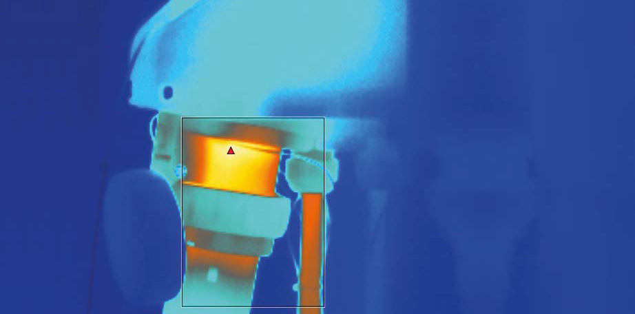 Die Thermografie-Aufnahme zeigt, wo bei einer Wandsteckdose mit Kupplung und integriertem Drehschaltermechanismus die Hotspots sind. Dort werden später  die Temperatursensoren aufgeklebt.(Thermografie-Aufnahme: © R. STAHL)